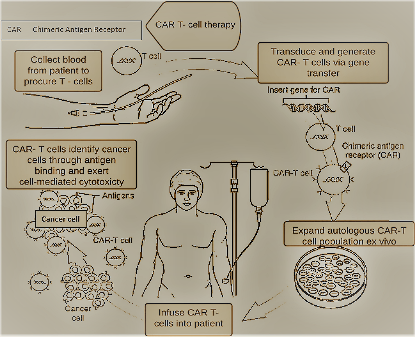 Overview-of-CAR-T-cell-treatment-being-administered-to-a-patient.
