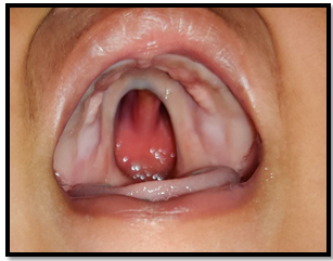 A close-up of a human mouth

Description automatically generated with low confidence