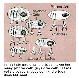 Illustration of too many plasma cells (myeloma cells)