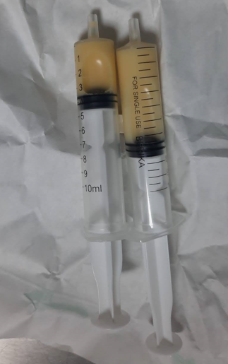 A pair of syringes with a brown substance

Description automatically generated