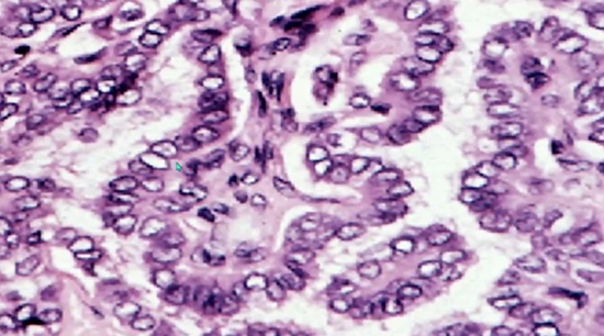 A microscope view of a human tissue

Description automatically generated