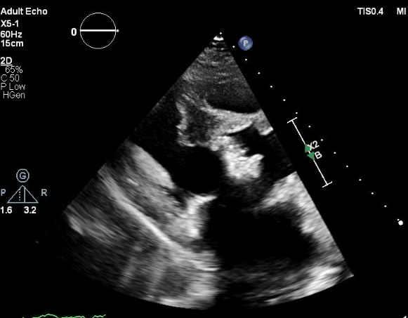 A close-up of an ultrasound

Description automatically generated