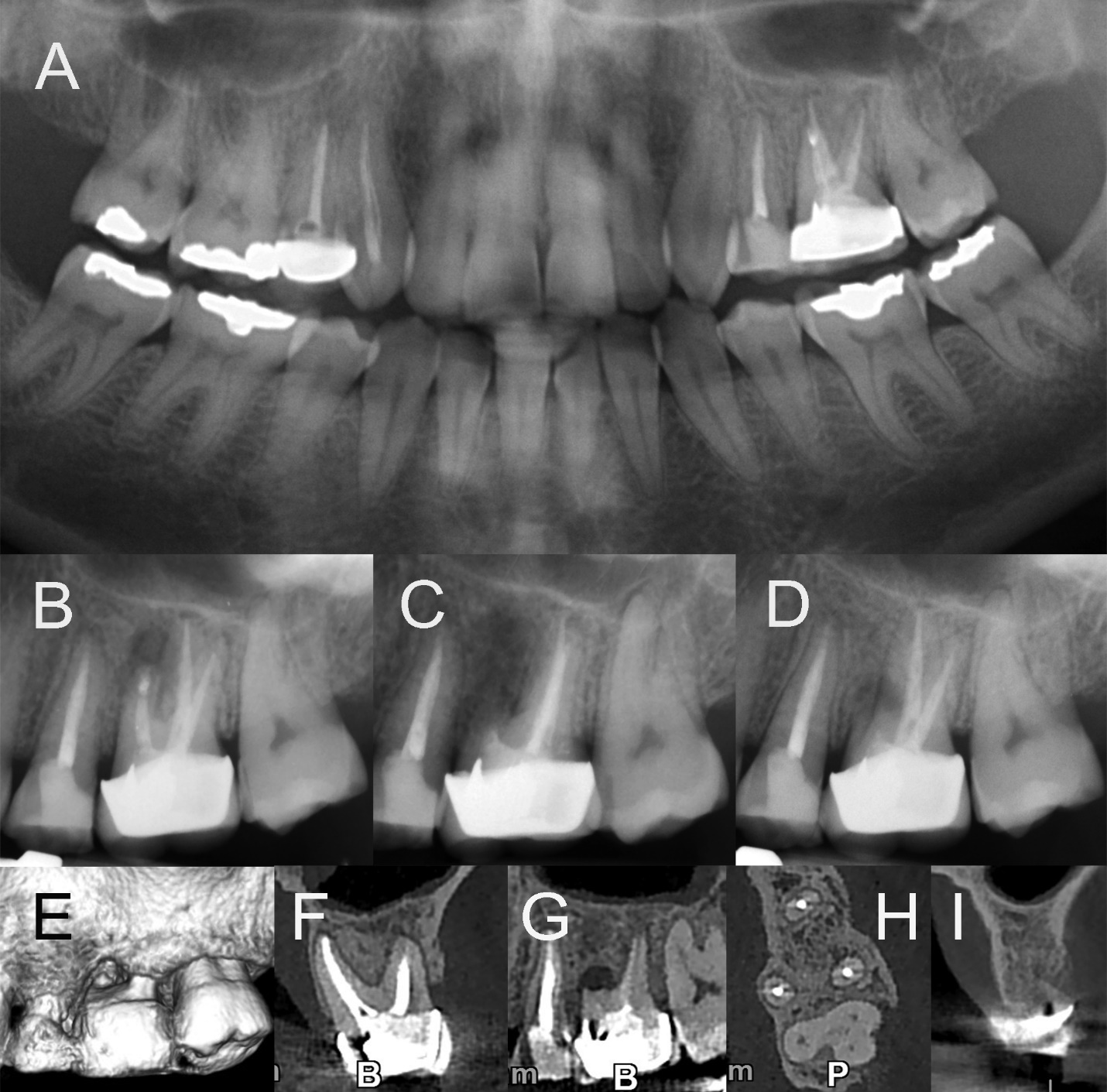 A close-up of a dental x-ray

Description automatically generated