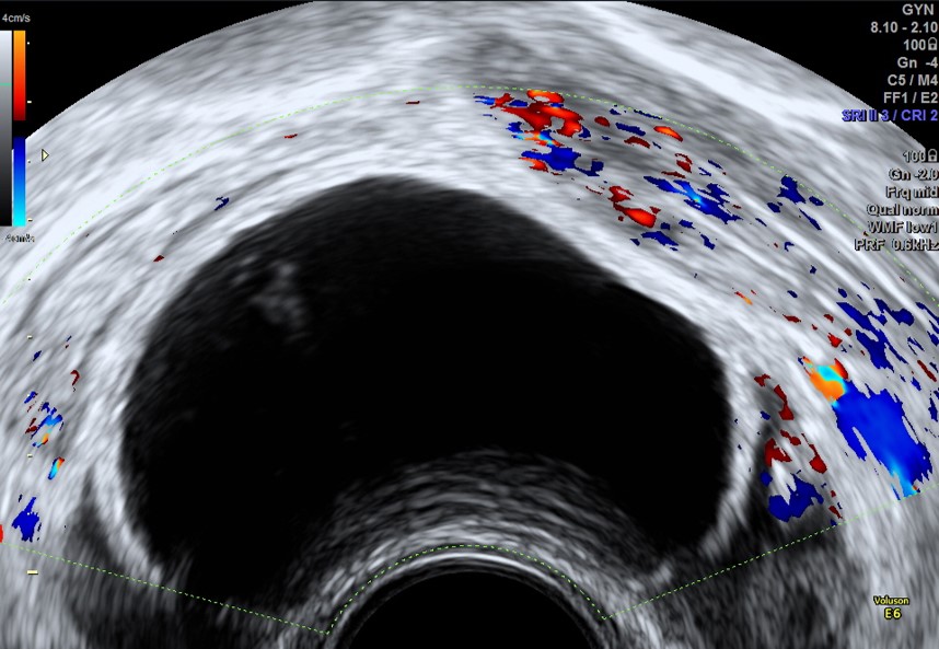 Ultrasound of a fetus

Description automatically generated
