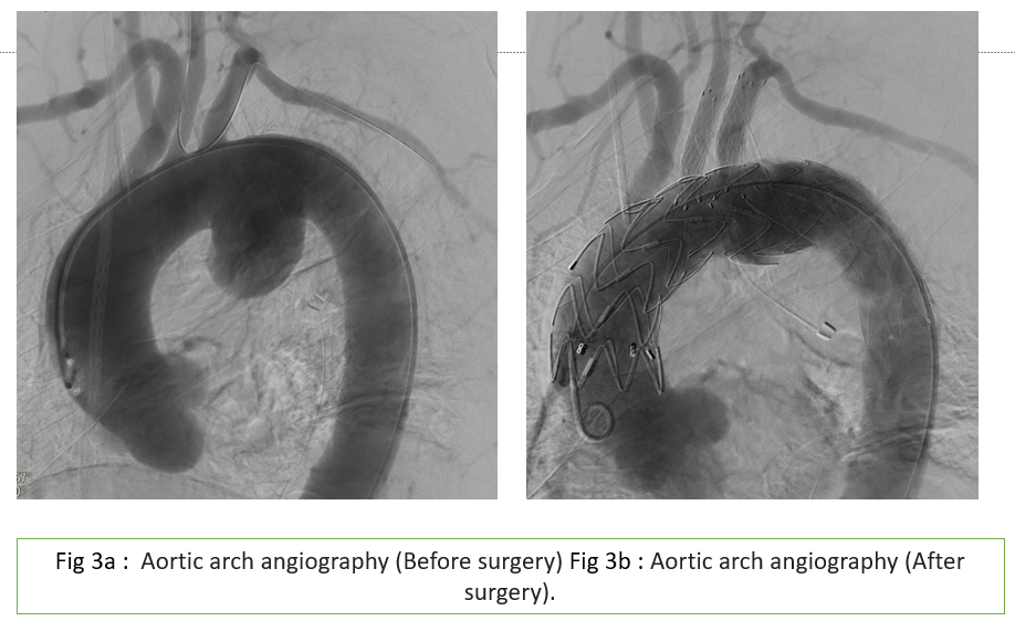 A close-up of an angiogram

Description automatically generated