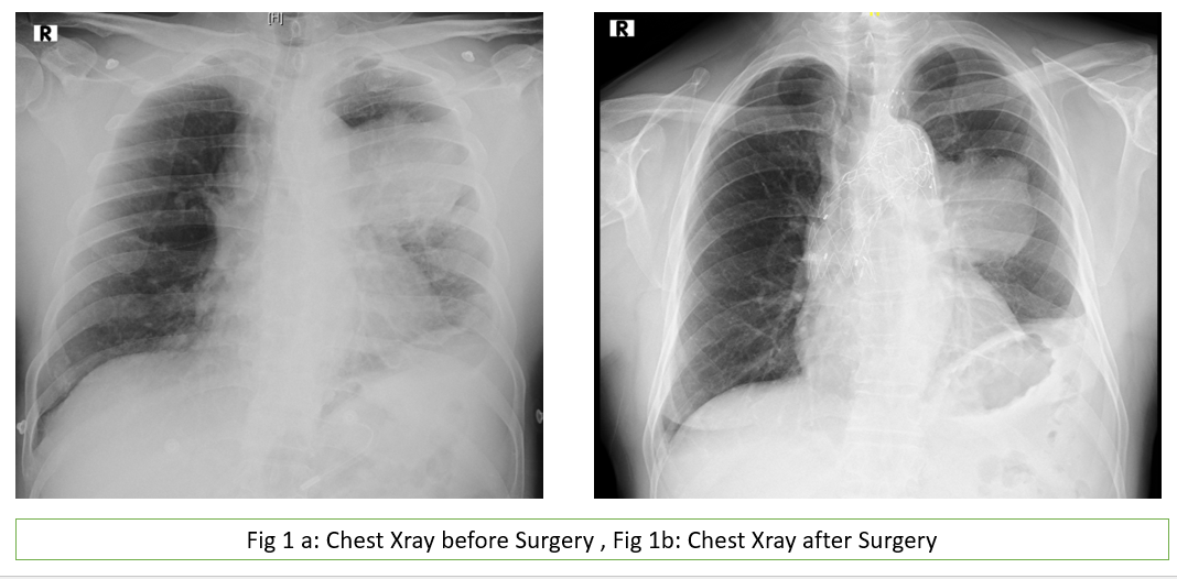 A chest x-ray of a person

Description automatically generated