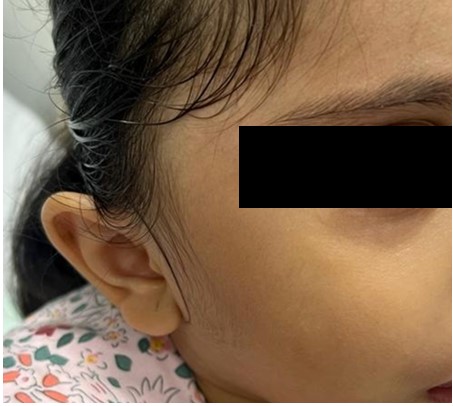 A close up of a child's face

Description automatically generated