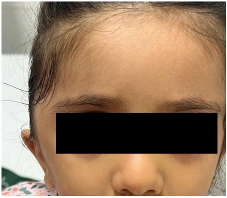 A close up of a child's face

Description automatically generated