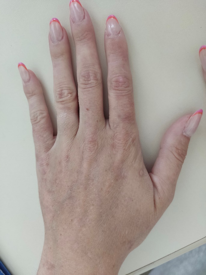 A close-up of a handDescription automatically generated