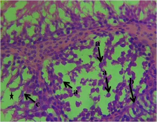 A microscope view of a lungDescription automatically generated