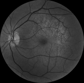 Une image contenant cercle, sphère, noir et blanc

Description générée automatiquement