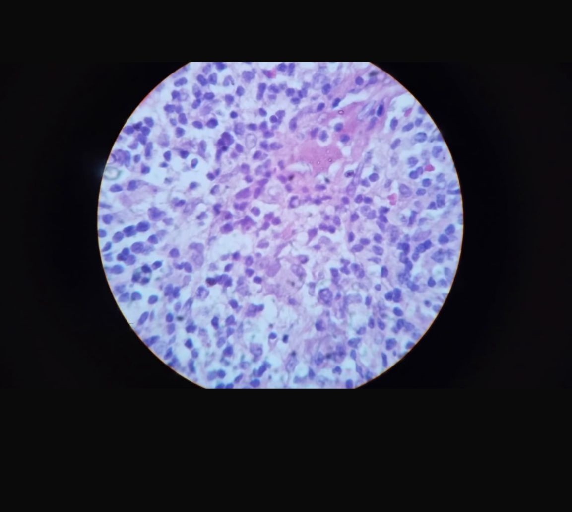 A close-up of a microscope

AI-generated content may be incorrect.