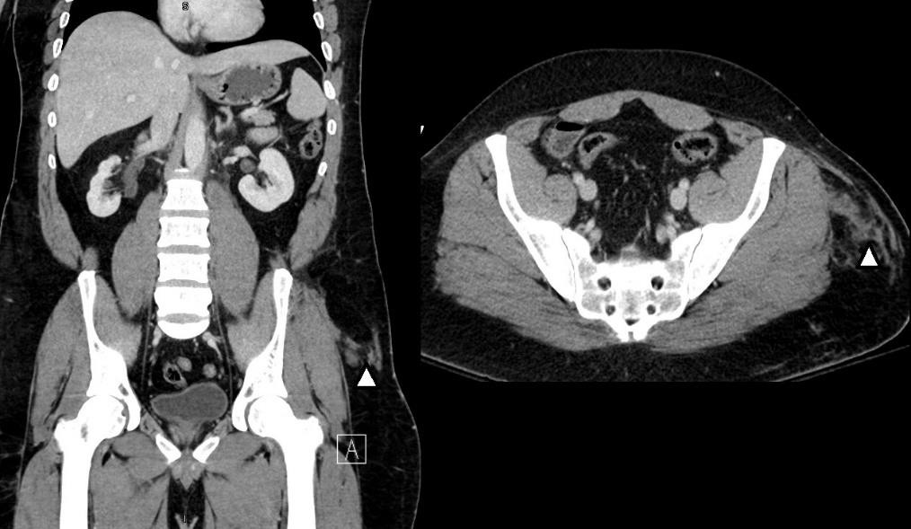 A close-up of an x-ray of a person  Description automatically generated