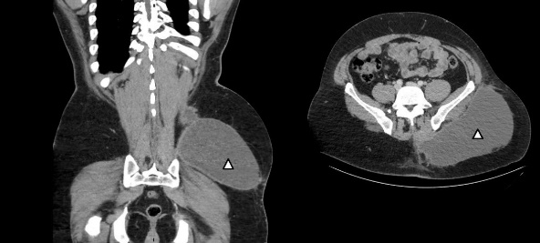 A close-up of a ct scan  Description automatically generated