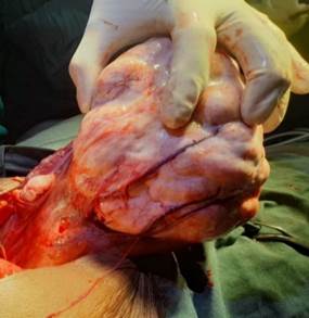 A person holding a wound

AI-generated content may be incorrect.