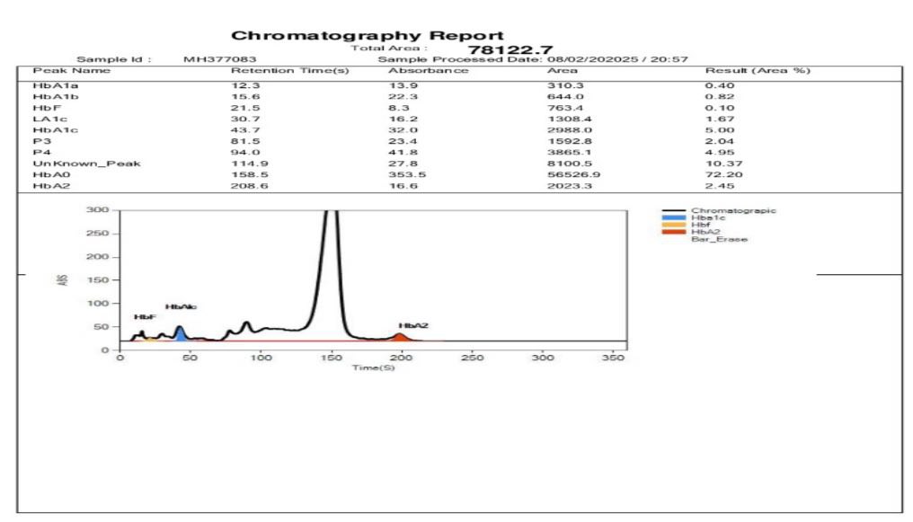 A screenshot of a chromatography report

AI-generated content may be incorrect.