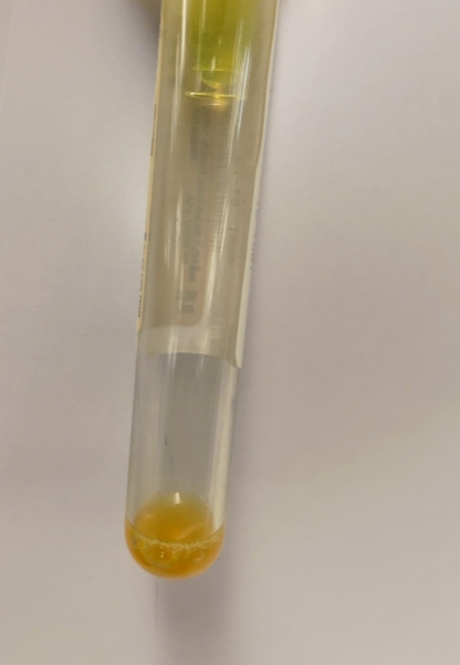 A test tube with a yellow substance
AI-generated content may be incorrect.