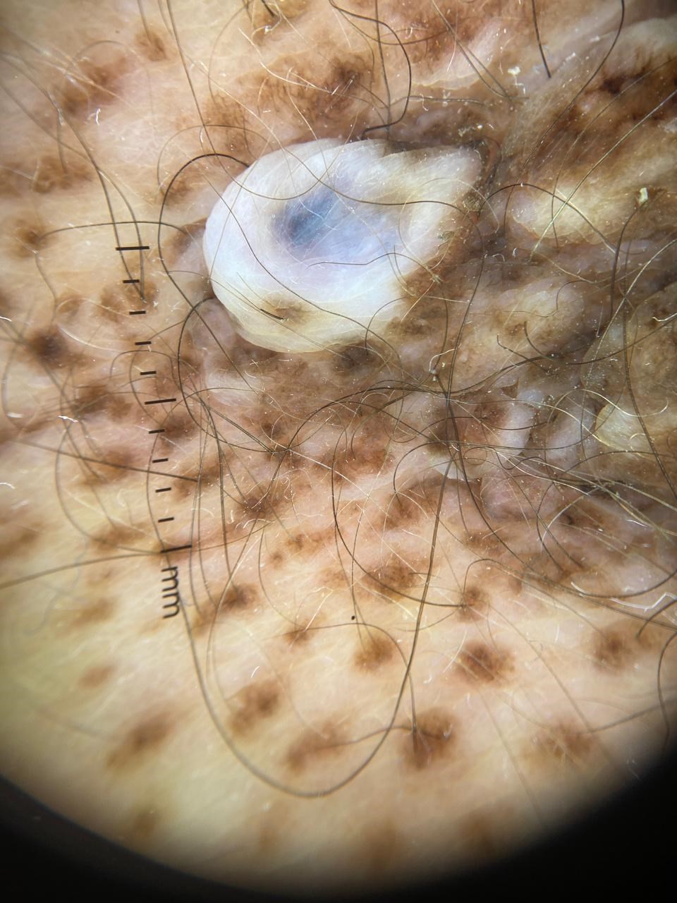 Close-up of a skin with hair all over it

AI-generated content may be incorrect.