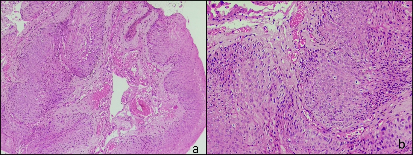 A close-up of a microscope

AI-generated content may be incorrect.
